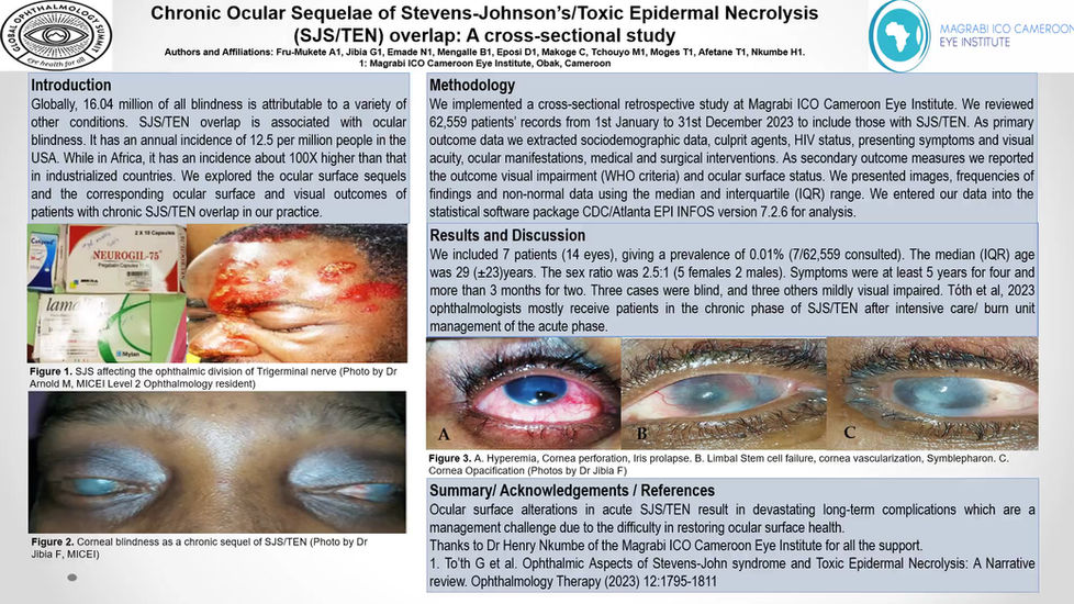 Chronic Ocular Sequelae of Stevens-Johnson's Syndrome/ Toxic Epidermal Necrolysis (SJS/TEN) Overlap: A cross-sectional study